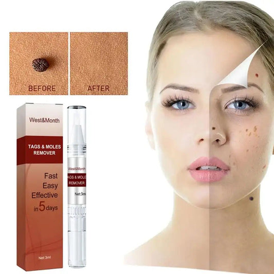 Natural Tags & Moles Remover
