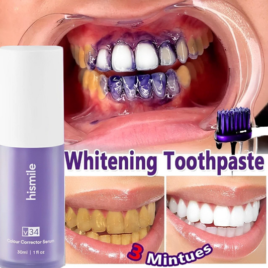 Hismile V34 Purple Tooth Stain Concealer – Color Corrector for White Teeth
