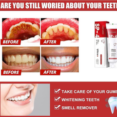 SP-4 Whitening Toothpaste with Probiotics – Fresh Breath & White Teeth